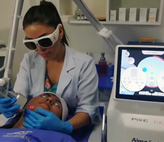 Jontelaser Fractional co2 laser